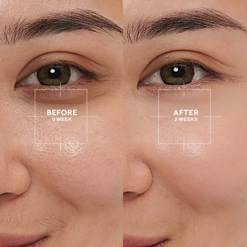 Wardah Renew You 1% Retinol Microcapsule Ceramide Cell Renewal Serum